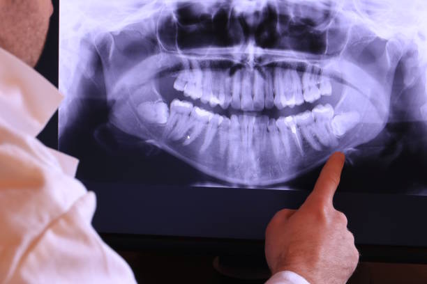 Best Pediatric Emergency Dentist in Fair Oaks, CA